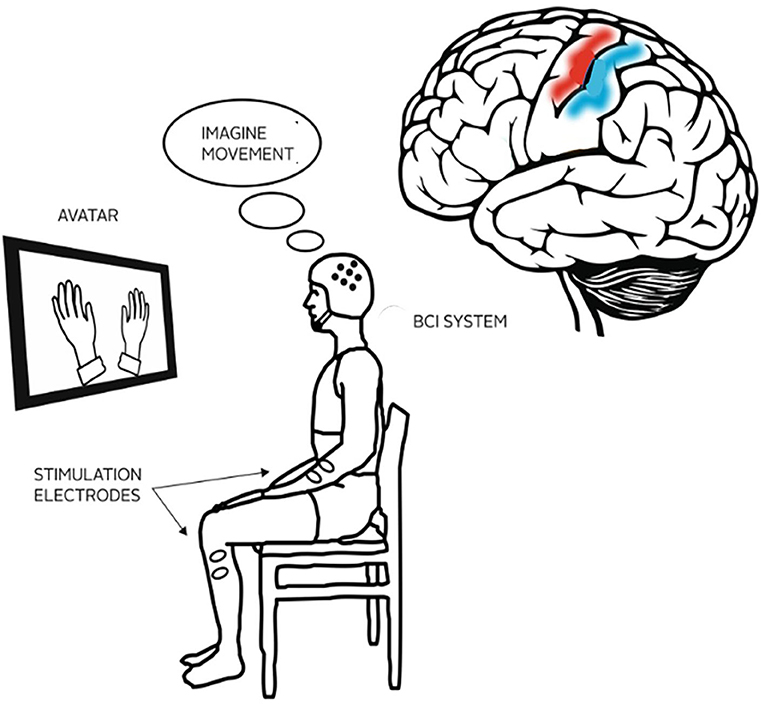 Stroke Motor-Imagery Classification via Transfer Learning